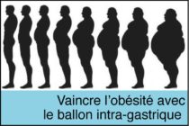Santé – Le Traitement médical de l’obésité grâce au “ballon intra-gastrique”