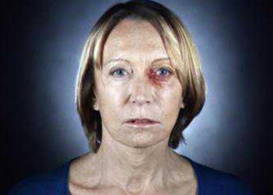 C’est aujourd’hui la journée de lutte contre les violences faites aux femmes